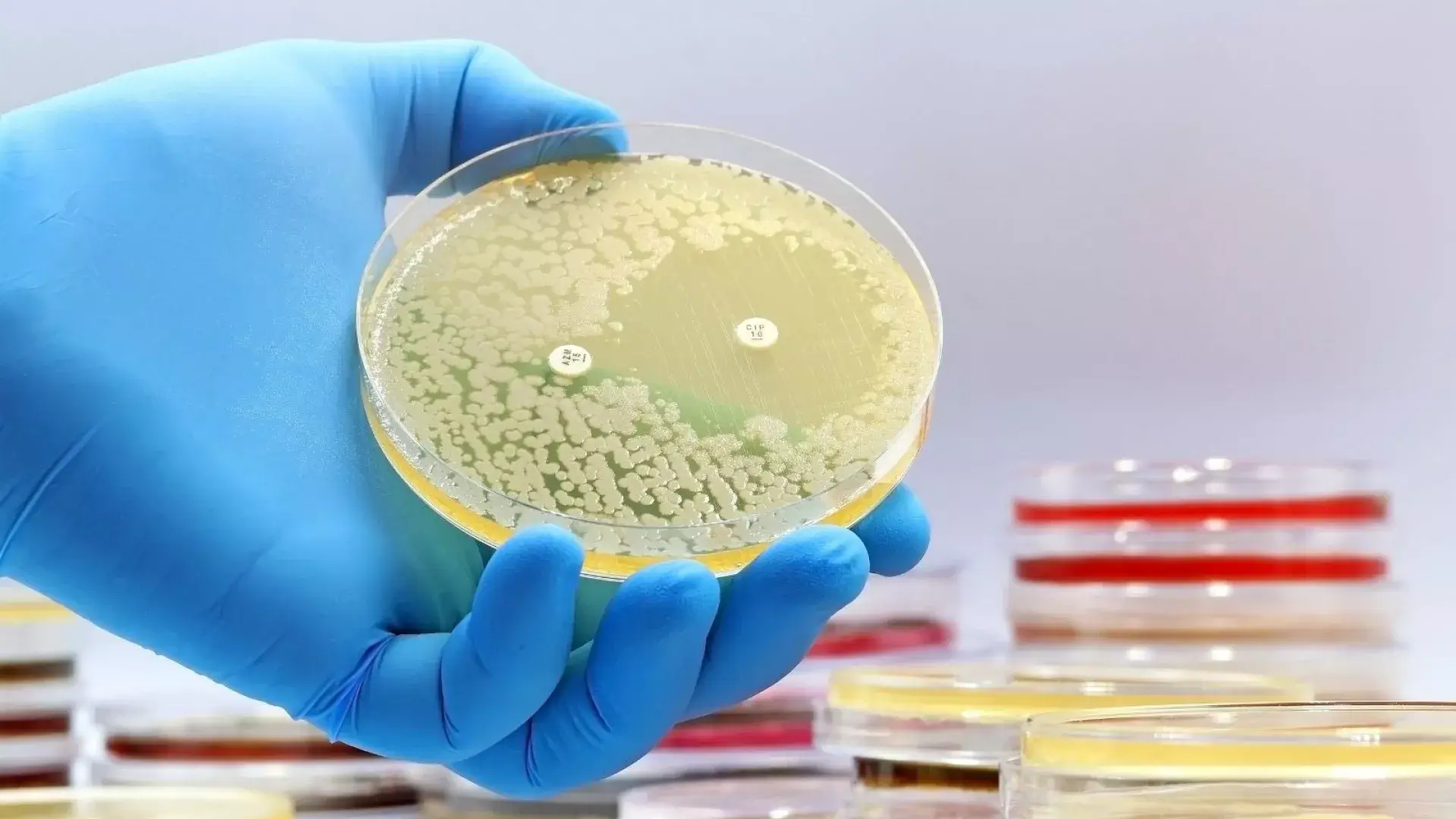 Identifican nueva clase de antibióticos para contrarrestar peligrosa bacteria farmacorresistente