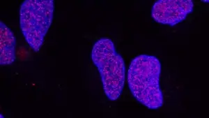 DBI: nueva molécula para detectar células cancerígenas