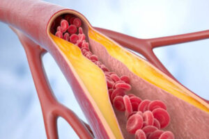 Lee más sobre el artículo Investigadores españoles revelan que una molécula producida por la microbiota intestinal puede inducir a la aterosclerosis